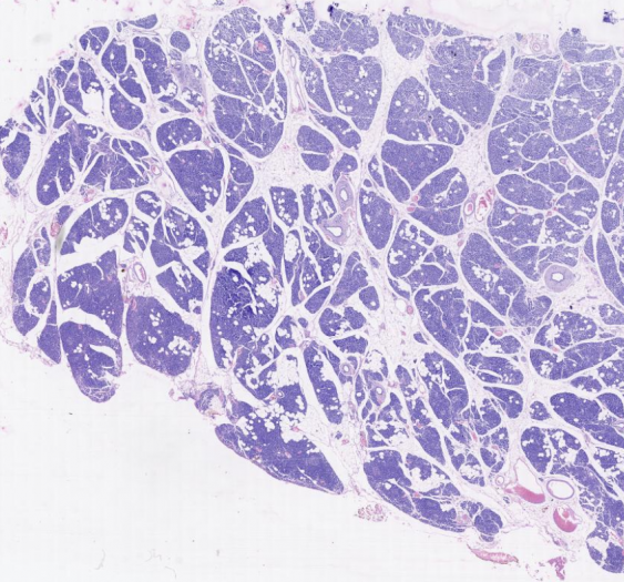 胰腺pancreas
