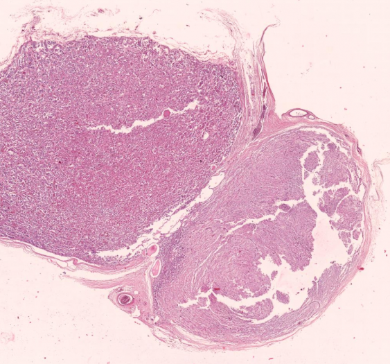 垂体pituitary