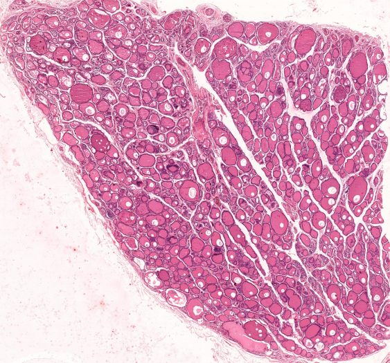 甲状腺thyroid