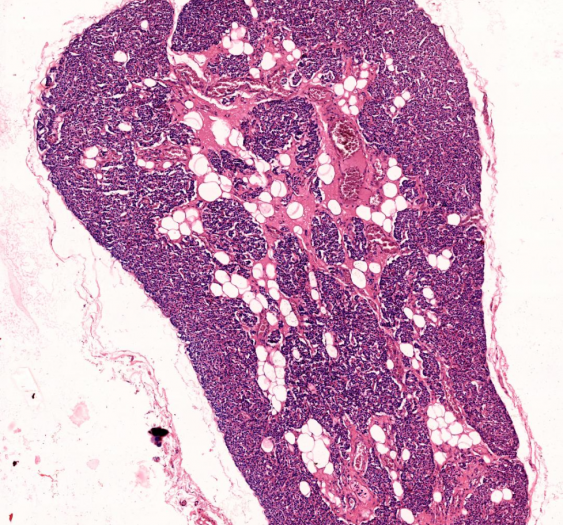 甲状腺旁Parathyroid gland