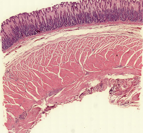 胃底Gastric fundus