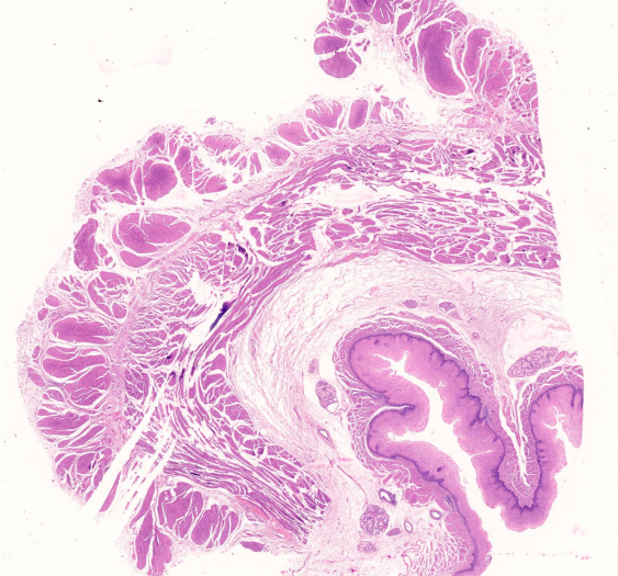 食管esophagus
