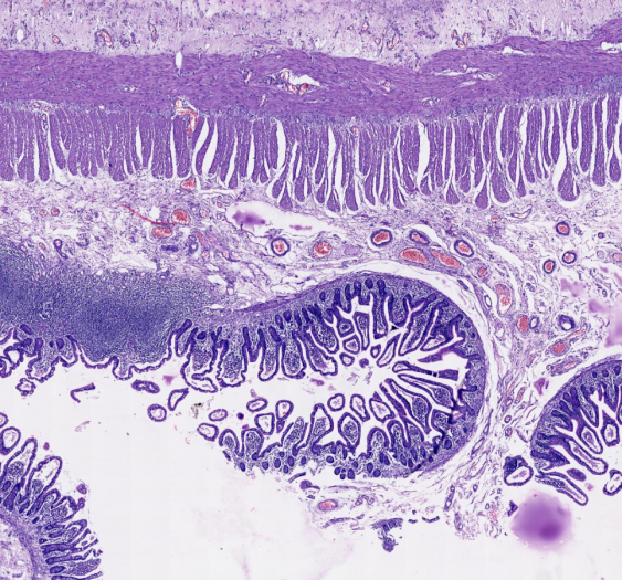 回肠ileum