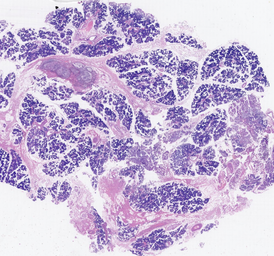 腮腺parotid gland