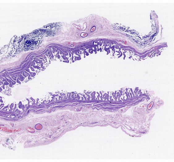 胆囊gallbladder
