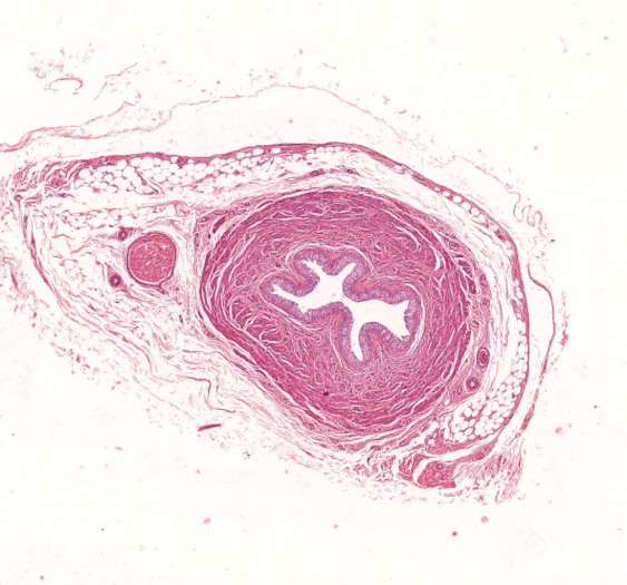 输尿管ureter