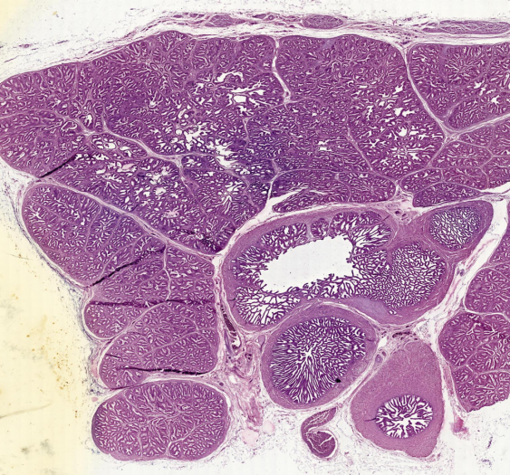 精囊seminal vesicle