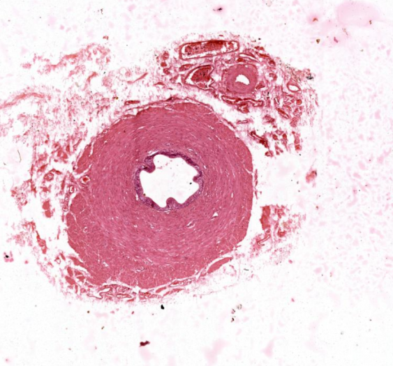 输精管vas deferens
