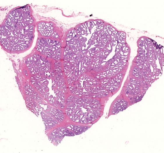 前列腺prostate