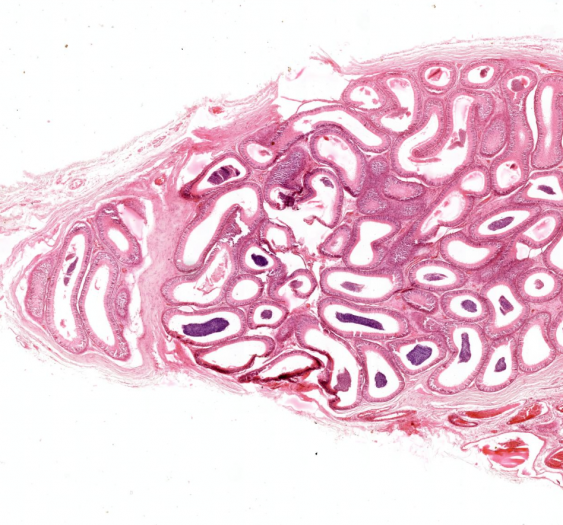 附睾epididymis
