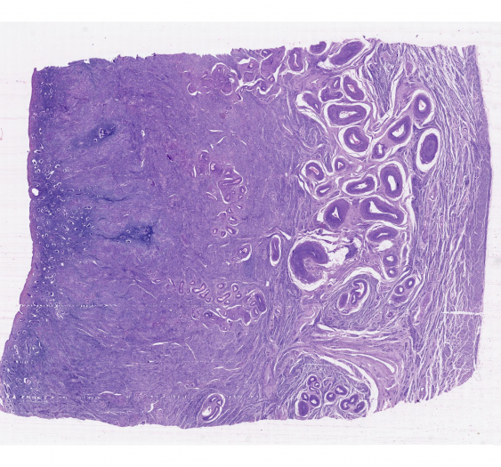 子宫uterus