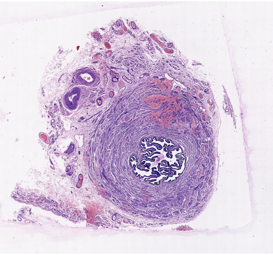 输卵管fallopian tube