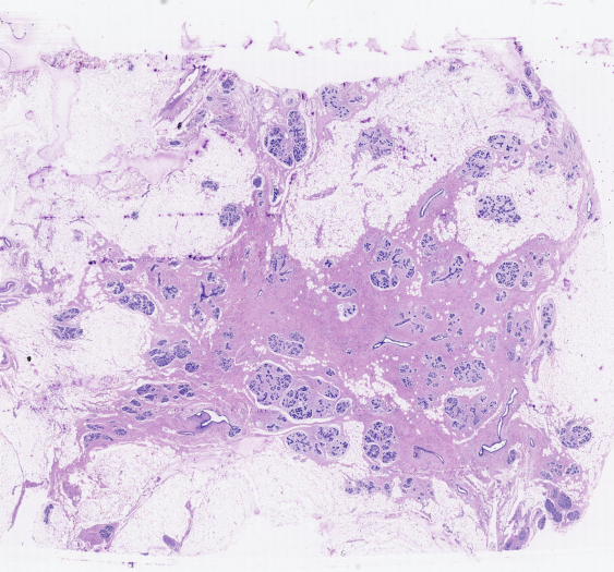 乳腺mammary gland