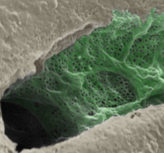 肝窦Hepatic sinus