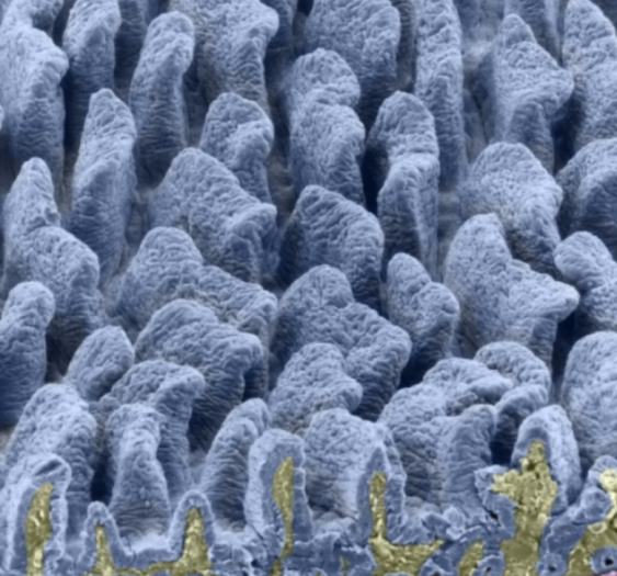 小肠绒毛Small intestinal villi