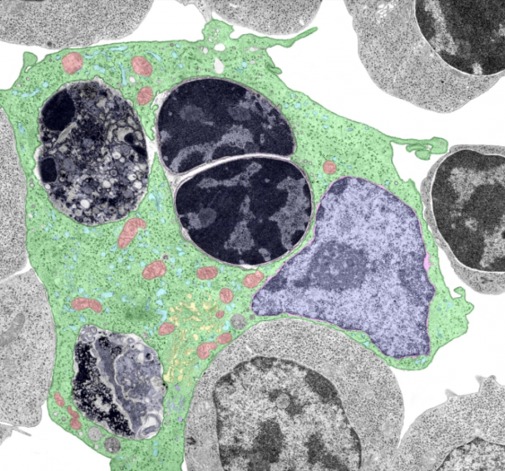 巨噬细胞macrophage