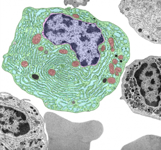 浆细胞plasma cell
