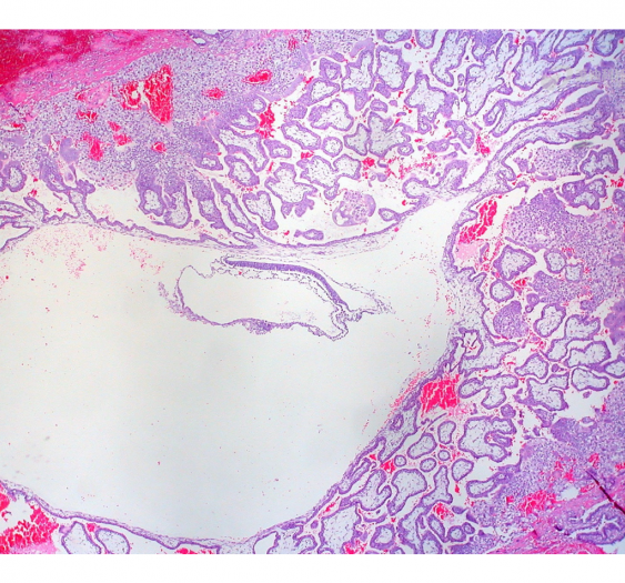 胎盘Placenta