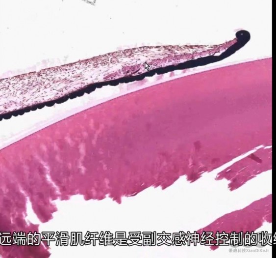 眼睛eye